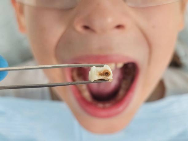 Best Emergency Pediatric Dentist  in Jonesville, MI